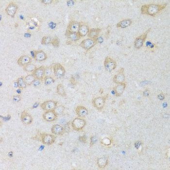 Immunohistochemistry - CHMP1B antibody (144-08239)