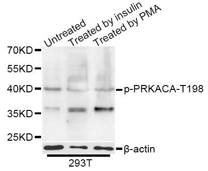 Western blot - Phospho-PRKACA-T197 pAb (144-50557)