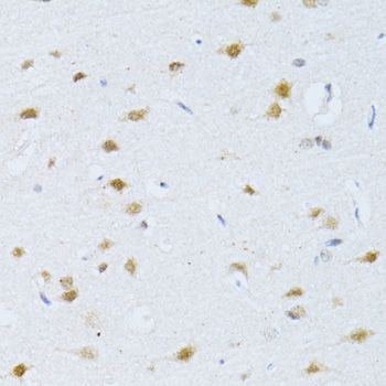 Immunohistochemistry - POLR2A Polyclonal Antibody (144-011181)