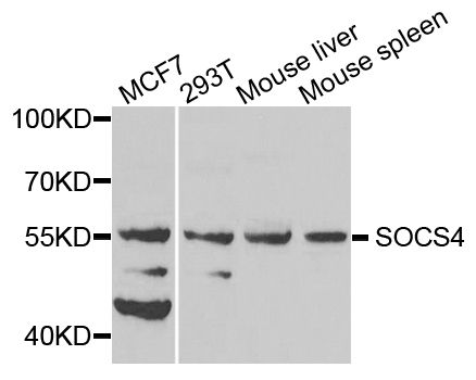 Western blot - SOCS4 antibody (144-08003)