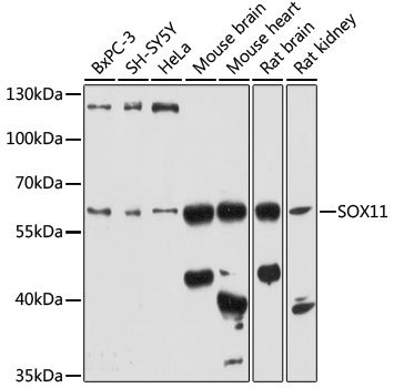 Western blot
