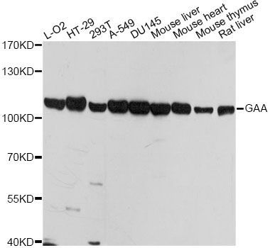 Western blot - GAA antibody (144-07674)
