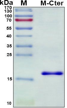 SDS-PAGE
