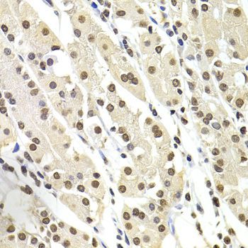 Immunohistochemistry - SOX5 Polyclonal Antibody (144-06985)