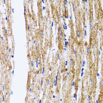 Immunohistochemistry - MAP1LC3B Polyclonal Antibody (144-07198)