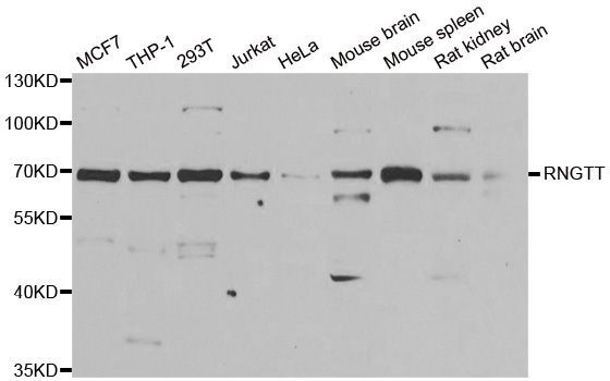 Western blot - RNGTT Polyclonal Antibody (144-06431)