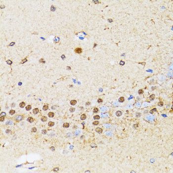 Immunohistochemistry - CHAF1B antibody (144-06259)