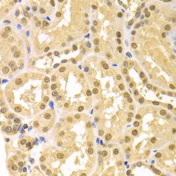 Immunohistochemistry - SFN Polyclonal Antibody (144-01026)