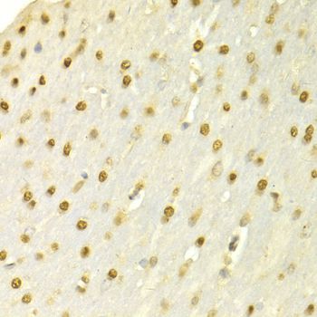 Immunohistochemistry - SFN Polyclonal Antibody (144-01026)