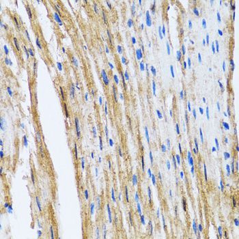 Immunohistochemistry - GOLM1 Polyclonal Antibody (144-07283)