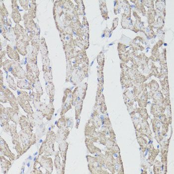 Immunohistochemistry - CD59 antibody (144-01689)
