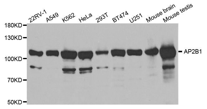 Western blot - AP2B1 antibody (144-01995)