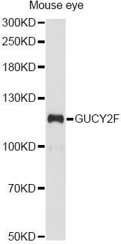 Western blot - GUCY2F antibody (144-60617)