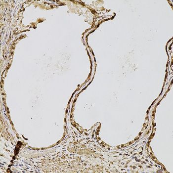 Immunohistochemistry - FGF2 Polyclonal Antibody (144-00235)