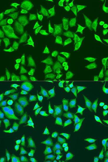 Immunofluorescence - SMN2 Polyclonal Antibody (144-01652)