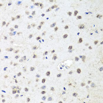 Immunohistochemistry - AGO2 antibody (144-06802)