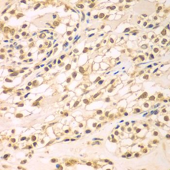Immunohistochemistry - TBL1XR1 antibody (144-07834)