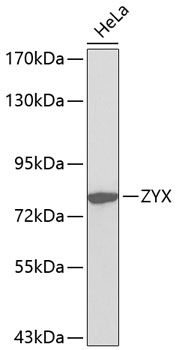 Western blot