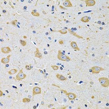 Immunohistochemistry - FASTKD1 Polyclonal Antibody (144-07384)