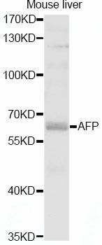 Western blot - AFP antibody (144-011013)