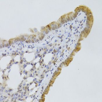 Immunohistochemistry - GPD2 Antibody (144-06611)