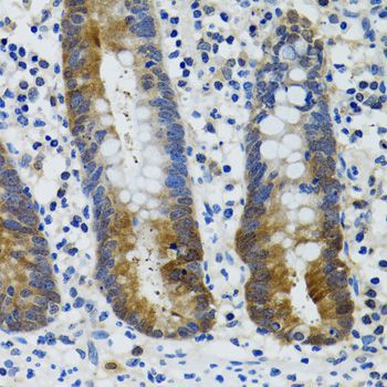 Immunohistochemistry - HSPH1 antibody (144-06622)