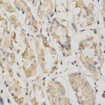 Immunohistochemistry - STK11 antibody (144-02122)