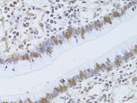 Immunohistochemistry - LMNB2 Polyclonal Antibody (144-06483)