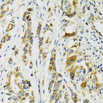 Immunohistochemistry - TNNC1 antibody (144-01927)