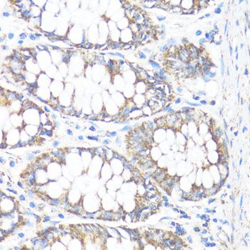 Immunohistochemistry - HSD17B10 antibody (144-05448)