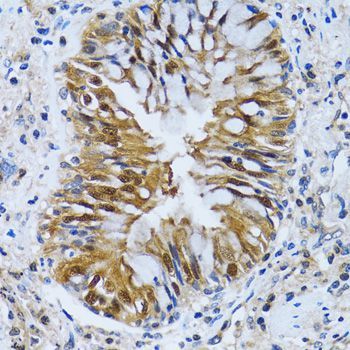 Immunohistochemistry - IMPA1 antibody (144-06381)