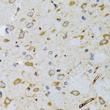 Immunohistochemistry - SRP19 Polyclonal Antibody (144-06752)