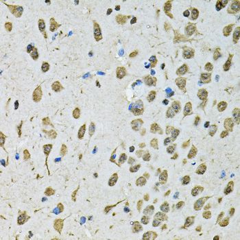 Immunohistochemistry - PSMB1 Polyclonal Antibody (144-01043)