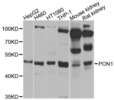 Western blot - PON1 antibody (144-01321)