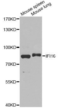 Western blot - IFI16 antibody (144-60546)