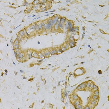 Immunohistochemistry - EIF4B Polyclonal Antibody (144-05405)