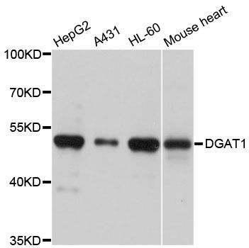 Western blot - DGAT1 Polyclonal Antibody (144-06857)