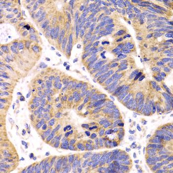 Immunohistochemistry - HMGCL antibody (144-08052)