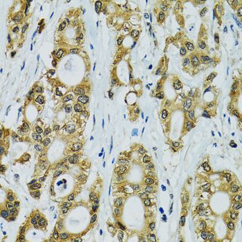 Immunohistochemistry - RPS7 Polyclonal Antibody (144-06731)