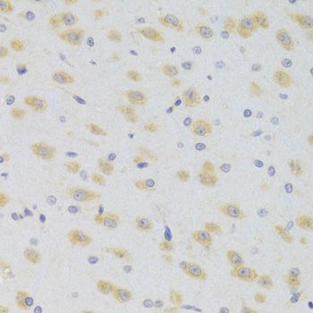 Immunohistochemistry - SCO2 Polyclonal Antibody (144-07051)