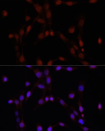 Immunofluorescence - PARP1 Polyclonal Antibody (144-60002)