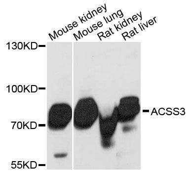 Western blot - ACSS3 antibody (144-60479)
