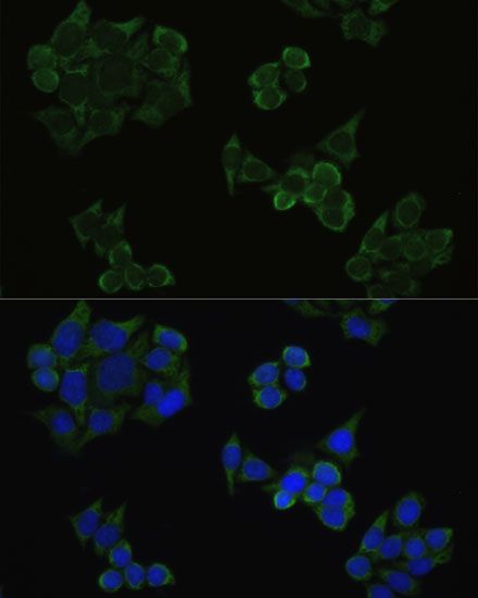 Immunofluorescence - Phospho-AKT1-T308 pAb (144-50304)