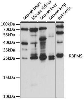 Western blot