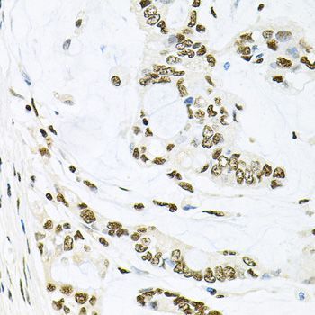 Immunohistochemistry - MAPK8 Polyclonal Antibody (144-00288)