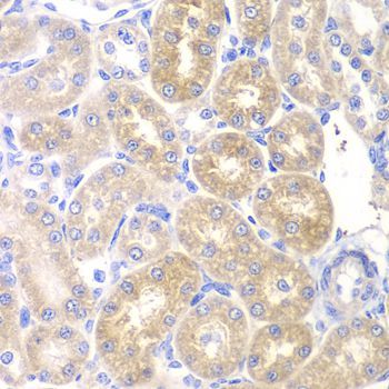 Immunohistochemistry - PNLIP Polyclonal Antibody (144-06396)