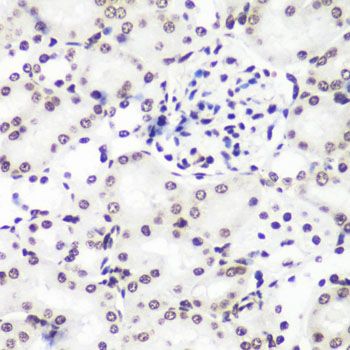 Immunohistochemistry - MonoMethyl-Histone H3-K9 pAb (144-02358)