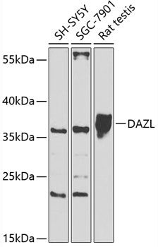 Western blot