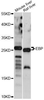 Western blot - EBP antibody (144-60820)