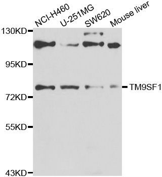 Western blot - TM9SF1 Polyclonal Antibody (144-07461)